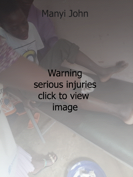 Warning Serious Wounds Click Image to View