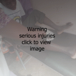 Warning Serious Wounds Click Image to View