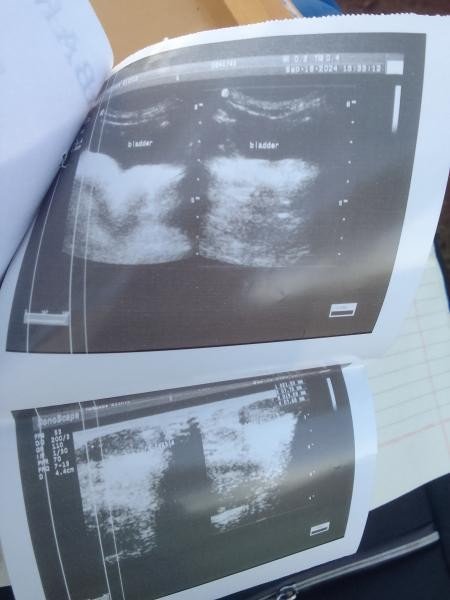 Kirimuntu Peter Campaign for Medical Assistance for mother