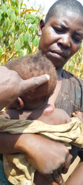 Child suffering